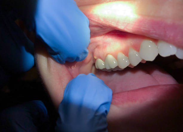 Best Weekend Emergency Dentist in Caldwell, OH