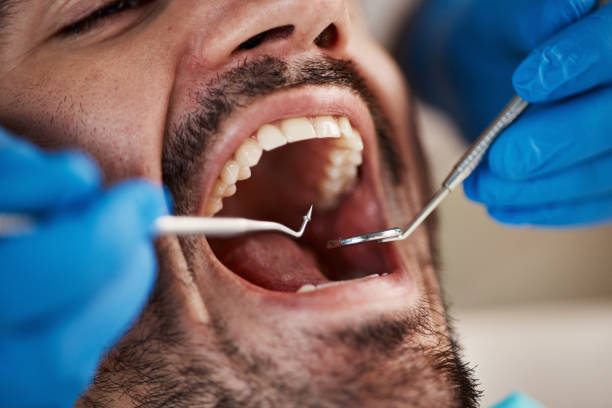 Best Emergency Dental Care for Abscessed Tooth in Caldwell, OH