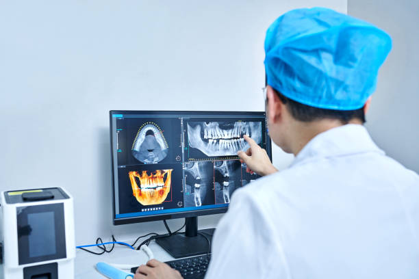 Best Emergency Dental Extractions in Caldwell, OH